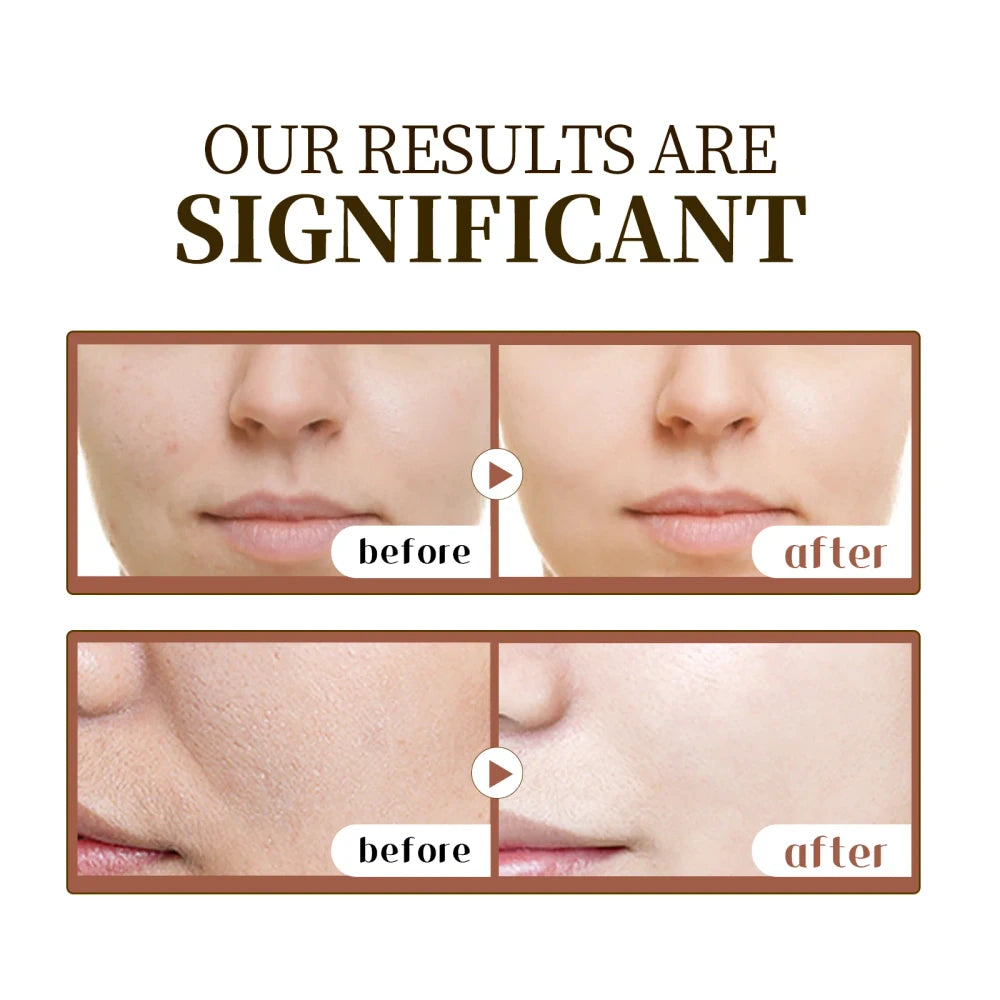 Centella Sensitive Skin Recovery Serum